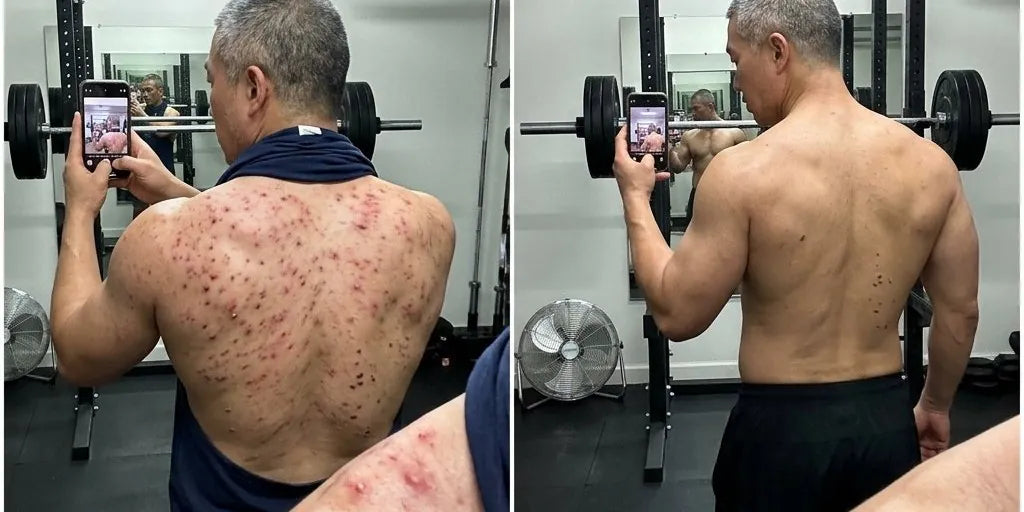 Ken's back before and after using Biosage patches