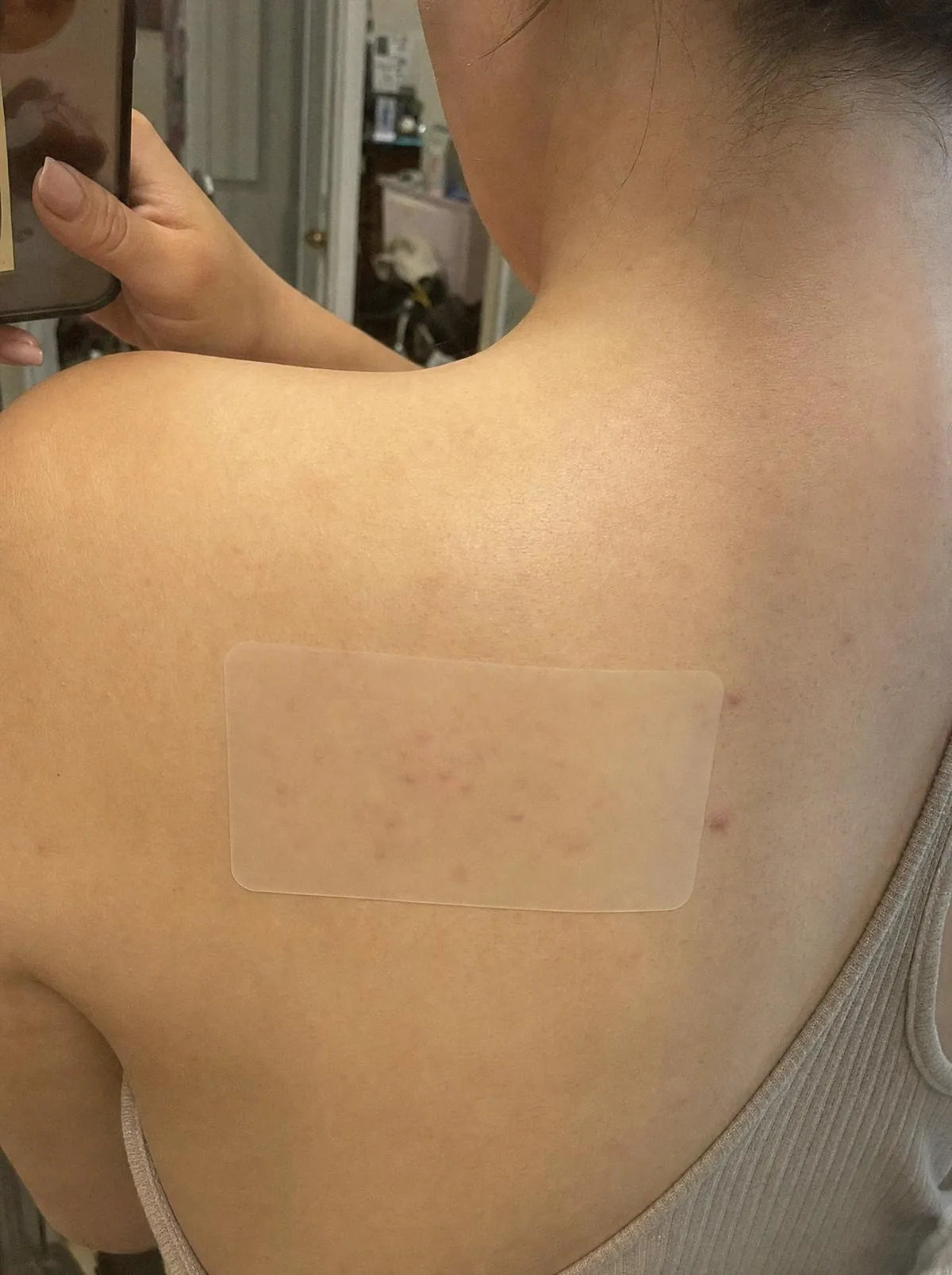 XL patch applied to an upper back